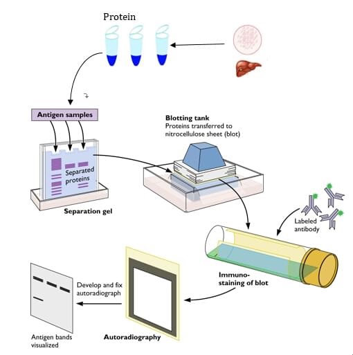  样本处理及检测（Qpcr、WB）